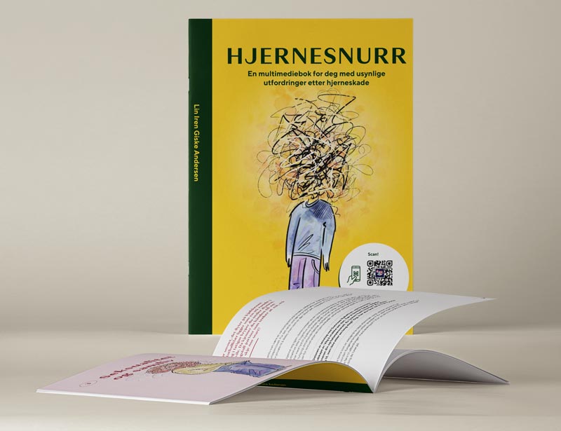 Bilde av omslaget til boken Hjernesnurr