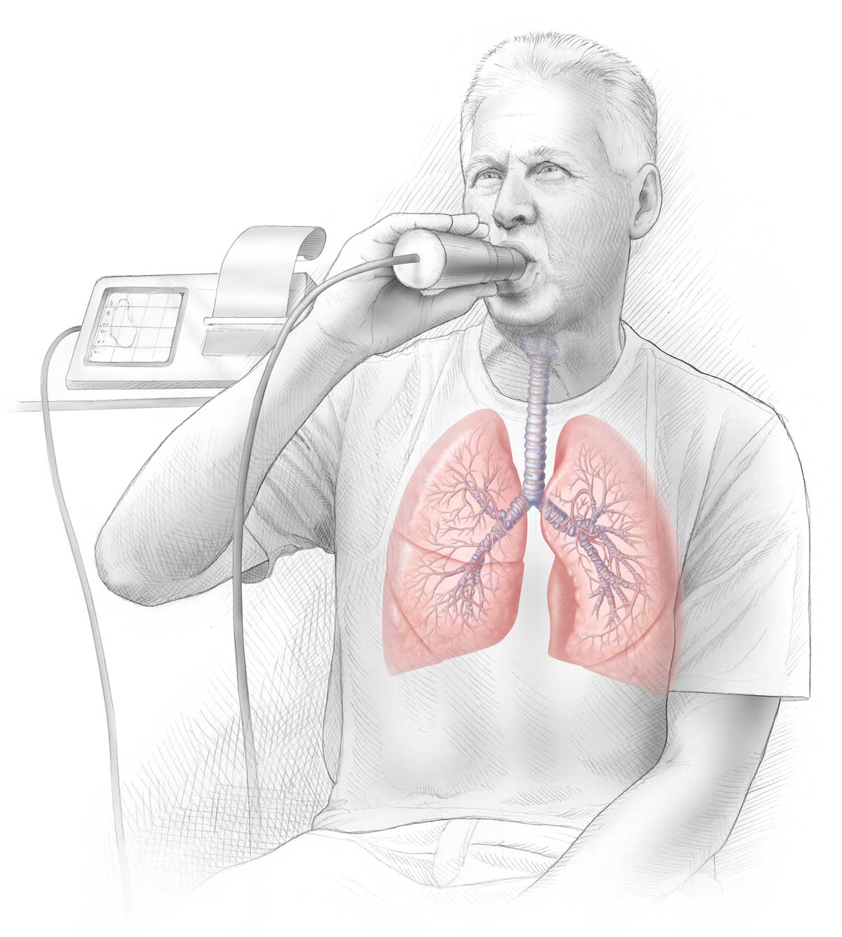 Spirometri